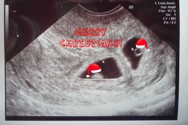 christmas ultrasound